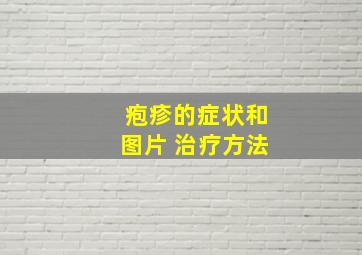 疱疹的症状和图片 治疗方法